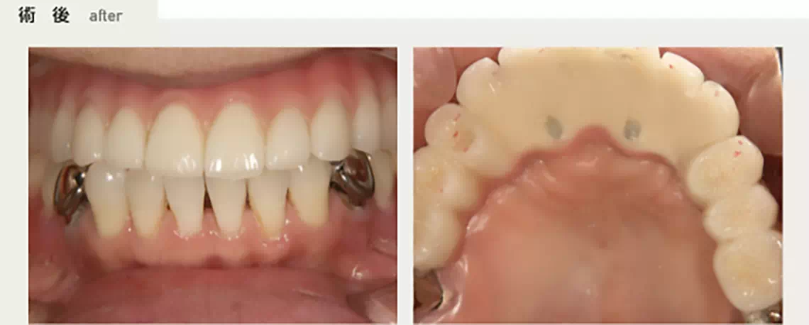 術後の画像