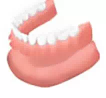 総入れ歯のイメージ画像